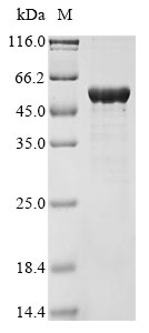 (Tris-Glycine gel) Discontinuous SDS-PAGE (reduced) with 5% enrichment gel and 15% separation gel. (Tris-Glycine gel) Discontinuous SDS-PAGE (reduced) with 5% enrichment gel and 15% separation gel.