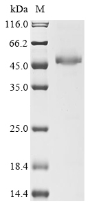 (Tris-Glycine gel) Discontinuous SDS-PAGE (reduced) with 5% enrichment gel and 15% separation gel. (Tris-Glycine gel) Discontinuous SDS-PAGE (reduced) with 5% enrichment gel and 15% separation gel.