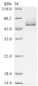 (Tris-Glycine gel) Discontinuous SDS-PAGE (reduced) with 5% enrichment gel and 15% separation gel. (Tris-Glycine gel) Discontinuous SDS-PAGE (reduced) with 5% enrichment gel and 15% separation gel.