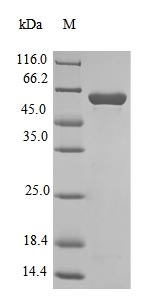 (Tris-Glycine gel) Discontinuous SDS-PAGE (reduced) with 5% enrichment gel and 15% separation gel.