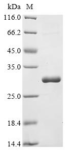 (Tris-Glycine gel) Discontinuous SDS-PAGE (reduced) with 5% enrichment gel and 15% separation gel.