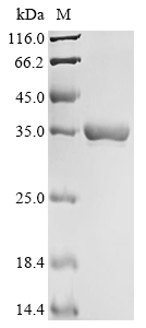 (Tris-Glycine gel) Discontinuous SDS-PAGE (reduced) with 5% enrichment gel and 15% separation gel. (Tris-Glycine gel) Discontinuous SDS-PAGE (reduced) with 5% enrichment gel and 15% separation gel.