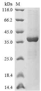 (Tris-Glycine gel) Discontinuous SDS-PAGE (reduced) with 5% enrichment gel and 15% separation gel. (Tris-Glycine gel) Discontinuous SDS-PAGE (reduced) with 5% enrichment gel and 15% separation gel.