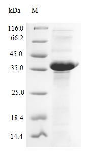 (Tris-Glycine gel) Discontinuous SDS-PAGE (reduced) with 5% enrichment gel and 15% separation gel.