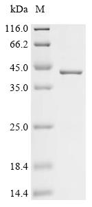Recombinant African swine fever virus B646L (p72) , partial - image 1