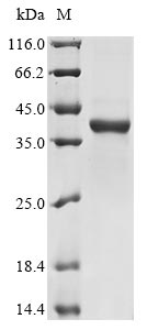 (Tris-Glycine gel) Discontinuous SDS-PAGE (reduced) with 5% enrichment gel and 15% separation gel.
