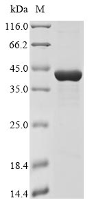 (Tris-Glycine gel) Discontinuous SDS-PAGE (reduced) with 5% enrichment gel and 15% separation gel. (Tris-Glycine gel) Discontinuous SDS-PAGE (reduced) with 5% enrichment gel and 15% separation gel.