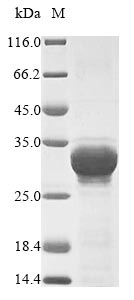 (Tris-Glycine gel) Discontinuous SDS-PAGE (reduced) with 5% enrichment gel and 15% separation gel. (Tris-Glycine gel) Discontinuous SDS-PAGE (reduced) with 5% enrichment gel and 15% separation gel.