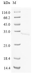 (Tris-Glycine gel) Discontinuous SDS-PAGE (reduced) with 5% enrichment gel and 15% separation gel. (Tris-Glycine gel) Discontinuous SDS-PAGE (reduced) with 5% enrichment gel and 15% separation gel.