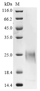 (Tris-Glycine gel) Discontinuous SDS-PAGE (reduced) with 5% enrichment gel and 15% separation gel. (Tris-Glycine gel) Discontinuous SDS-PAGE (reduced) with 5% enrichment gel and 15% separation gel.