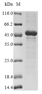 (Tris-Glycine gel) Discontinuous SDS-PAGE (reduced) with 5% enrichment gel and 15% separation gel.