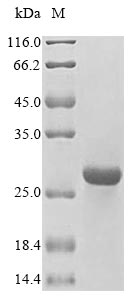 SDS-PAGE- Recombinant protein Human HLA-DMB