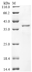 (Tris-Glycine gel) Discontinuous SDS-PAGE (reduced) with 5% enrichment gel and 15% separation gel.