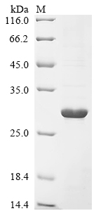 (Tris-Glycine gel) Discontinuous SDS-PAGE (reduced) with 5% enrichment gel and 15% separation gel.