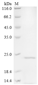 Recombinant Mycobacterium intracellulare Lipoprotein lpqH (lpqH) - image 1