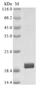 (Tris-Glycine gel) Discontinuous SDS-PAGE (reduced) with 5% enrichment gel and 15% separation gel. (Tris-Glycine gel) Discontinuous SDS-PAGE (reduced) with 5% enrichment gel and 15% separation gel.