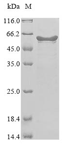 Recombinant Human coronavirus OC43 Nucleoprotein (N) - image 1