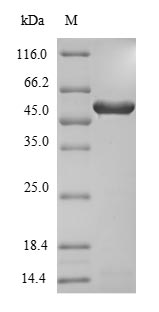 (Tris-Glycine gel) Discontinuous SDS-PAGE (reduced) with 5% enrichment gel and 15% separation gel.