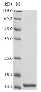 (Tris-Glycine gel) Discontinuous SDS-PAGE (reduced) with 5% enrichment gel and 15% separation gel. (Tris-Glycine gel) Discontinuous SDS-PAGE (reduced) with 5% enrichment gel and 15% separation gel.