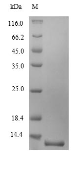 (Tris-Glycine gel) Discontinuous SDS-PAGE (reduced) with 5% enrichment gel and 15% separation gel. (Tris-Glycine gel) Discontinuous SDS-PAGE (reduced) with 5% enrichment gel and 15% separation gel.