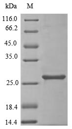 (Tris-Glycine gel) Discontinuous SDS-PAGE (reduced) with 5% enrichment gel and 15% separation gel.