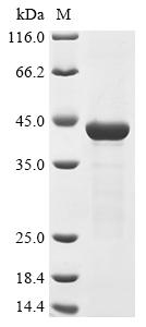 (Tris-Glycine gel) Discontinuous SDS-PAGE (reduced) with 5% enrichment gel and 15% separation gel. (Tris-Glycine gel) Discontinuous SDS-PAGE (reduced) with 5% enrichment gel and 15% separation gel.