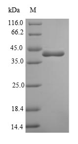 (Tris-Glycine gel) Discontinuous SDS-PAGE (reduced) with 5% enrichment gel and 15% separation gel.
