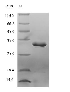 (Tris-Glycine gel) Discontinuous SDS-PAGE (reduced) with 5% enrichment gel and 15% separation gel. (Tris-Glycine gel) Discontinuous SDS-PAGE (reduced) with 5% enrichment gel and 15% separation gel.