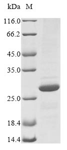 (Tris-Glycine gel) Discontinuous SDS-PAGE (reduced) with 5% enrichment gel and 15% separation gel. (Tris-Glycine gel) Discontinuous SDS-PAGE (reduced) with 5% enrichment gel and 15% separation gel.