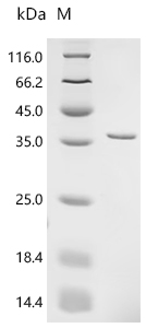 Recombinant Mycobacterium tuberculosis Protein grpE (grpE) - image 1