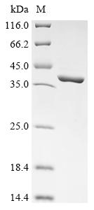 (Tris-Glycine gel) Discontinuous SDS-PAGE (reduced) with 5% enrichment gel and 15% separation gel. (Tris-Glycine gel) Discontinuous SDS-PAGE (reduced) with 5% enrichment gel and 15% separation gel.