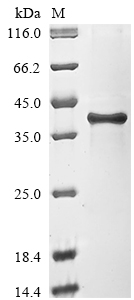 (Tris-Glycine gel) Discontinuous SDS-PAGE (reduced) with 5% enrichment gel and 15% separation gel. (Tris-Glycine gel) Discontinuous SDS-PAGE (reduced) with 5% enrichment gel and 15% separation gel.