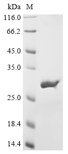 (Tris-Glycine gel) Discontinuous SDS-PAGE (reduced) with 5% enrichment gel and 15% separation gel. (Tris-Glycine gel) Discontinuous SDS-PAGE (reduced) with 5% enrichment gel and 15% separation gel.