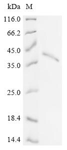 Recombinant Puumala virus Envelope glycoprotein (GP) , partial - image 1