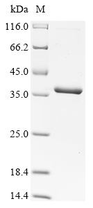 (Tris-Glycine gel) Discontinuous SDS-PAGE (reduced) with 5% enrichment gel and 15% separation gel. (Tris-Glycine gel) Discontinuous SDS-PAGE (reduced) with 5% enrichment gel and 15% separation gel.