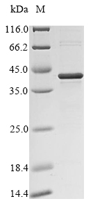 (Tris-Glycine gel) Discontinuous SDS-PAGE (reduced) with 5% enrichment gel and 15% separation gel. (Tris-Glycine gel) Discontinuous SDS-PAGE (reduced) with 5% enrichment gel and 15% separation gel.