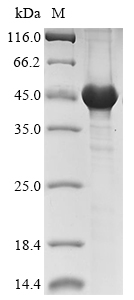 (Tris-Glycine gel) Discontinuous SDS-PAGE (reduced) with 5% enrichment gel and 15% separation gel. (Tris-Glycine gel) Discontinuous SDS-PAGE (reduced) with 5% enrichment gel and 15% separation gel.