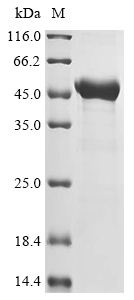(Tris-Glycine gel) Discontinuous SDS-PAGE (reduced) with 5% enrichment gel and 15% separation gel. (Tris-Glycine gel) Discontinuous SDS-PAGE (reduced) with 5% enrichment gel and 15% separation gel.