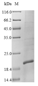 (Tris-Glycine gel) Discontinuous SDS-PAGE (reduced) with 5% enrichment gel and 15% separation gel. (Tris-Glycine gel) Discontinuous SDS-PAGE (reduced) with 5% enrichment gel and 15% separation gel.
