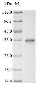 (Tris-Glycine gel) Discontinuous SDS-PAGE (reduced) with 5% enrichment gel and 15% separation gel. (Tris-Glycine gel) Discontinuous SDS-PAGE (reduced) with 5% enrichment gel and 15% separation gel.