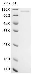Recombinant Human Trifunctional enzyme subunit alpha, mitochondrial (HADHA) - image 1