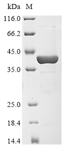 (Tris-Glycine gel) Discontinuous SDS-PAGE (reduced) with 5% enrichment gel and 15% separation gel. (Tris-Glycine gel) Discontinuous SDS-PAGE (reduced) with 5% enrichment gel and 15% separation gel.