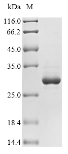 (Tris-Glycine gel) Discontinuous SDS-PAGE (reduced) with 5% enrichment gel and 15% separation gel.