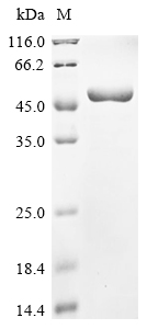 (Tris-Glycine gel) Discontinuous SDS-PAGE (reduced) with 5% enrichment gel and 15% separation gel. (Tris-Glycine gel) Discontinuous SDS-PAGE (reduced) with 5% enrichment gel and 15% separation gel.