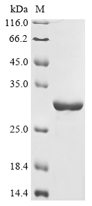 Recombinant Junin mammarenavirus Pre-glycoprotein polyprotein GP complex (GPC) , partial - image 1