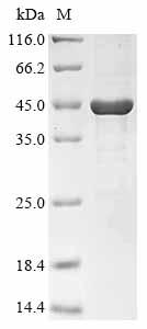 (Tris-Glycine gel) Discontinuous SDS-PAGE (reduced) with 5% enrichment gel and 15% separation gel. (Tris-Glycine gel) Discontinuous SDS-PAGE (reduced) with 5% enrichment gel and 15% separation gel.