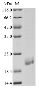 (Tris-Glycine gel) Discontinuous SDS-PAGE (reduced) with 5% enrichment gel and 15% separation gel. (Tris-Glycine gel) Discontinuous SDS-PAGE (reduced) with 5% enrichment gel and 15% separation gel.