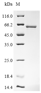 (Tris-Glycine gel) Discontinuous SDS-PAGE (reduced) with 5% enrichment gel and 15% separation gel. (Tris-Glycine gel) Discontinuous SDS-PAGE (reduced) with 5% enrichment gel and 15% separation gel.