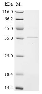 Recombinant Rat Troponin T, cardiac muscle (Tnnt2) - image 1