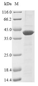 (Tris-Glycine gel) Discontinuous SDS-PAGE (reduced) with 5% enrichment gel and 15% separation gel.